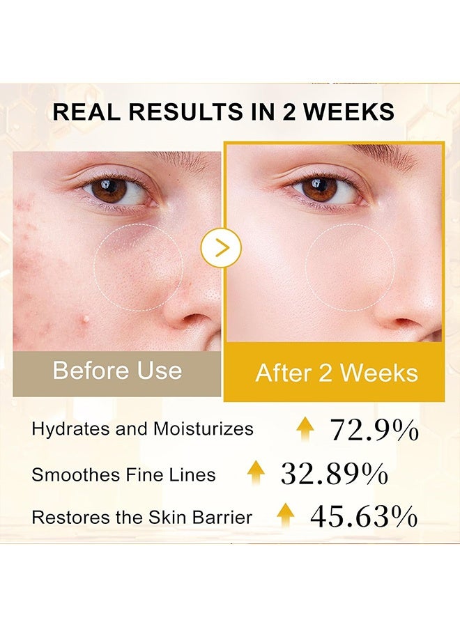 LANEMAY Bee Venom Firming and Rejuvenating Essence Lotion - Gentle Moisturizing Toning Facial Care Base Liquid 30ml - Image 4